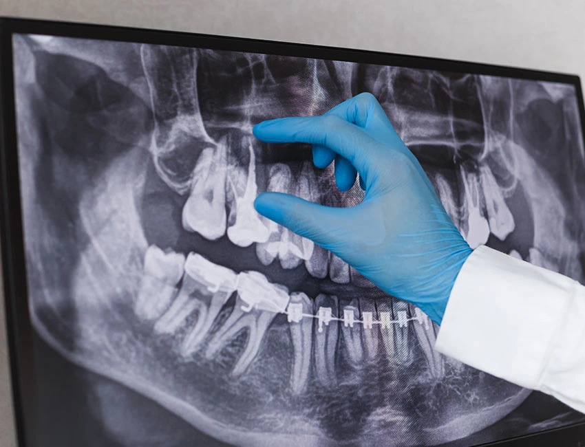 Dentist reviewing dental X-ray result