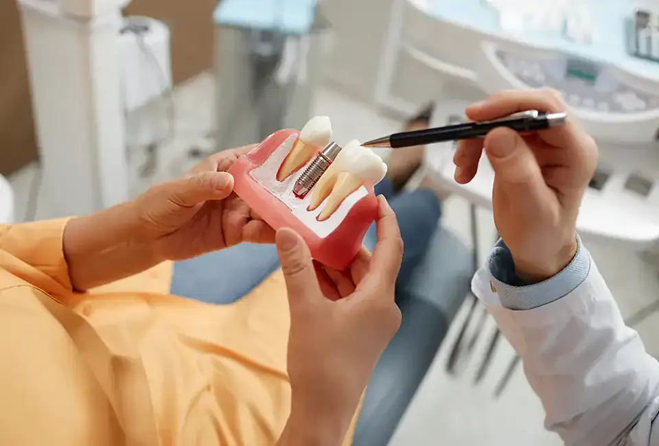 dental implants in Torrance model