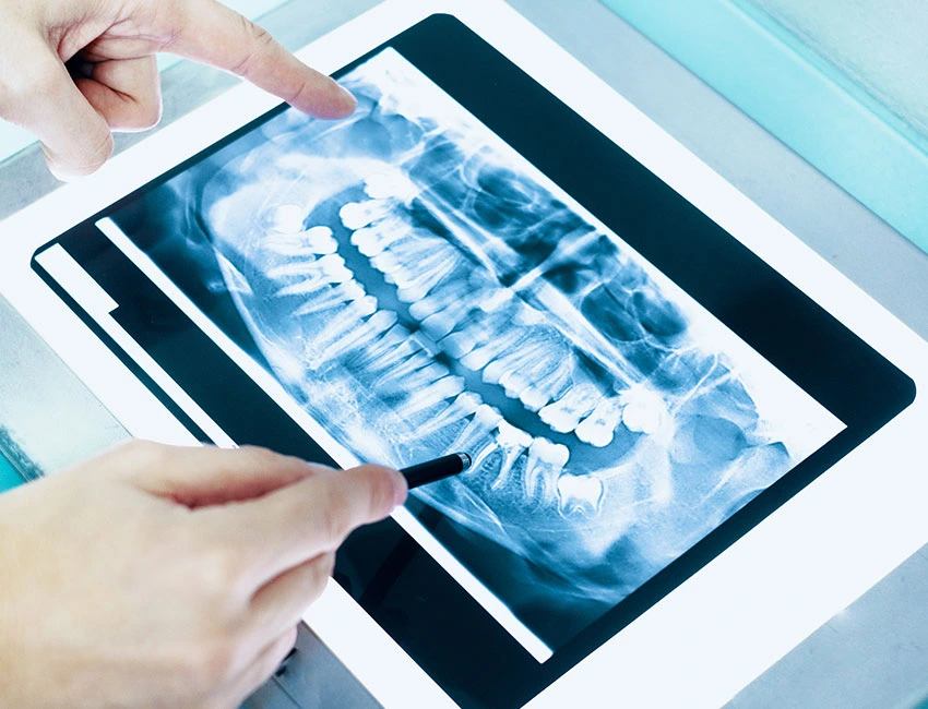 Dental digital X-ray in Torrance, 90503