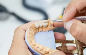 Dentist working on dental crowns in Torrance, CA